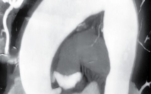 每日一题_2024.12.14