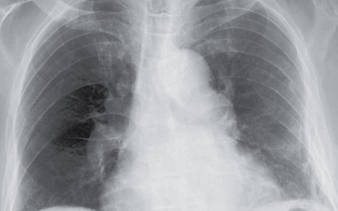 每日一题_2024.12.29