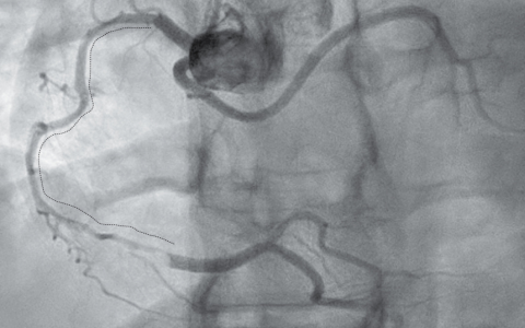 每日一题_2024.12.01