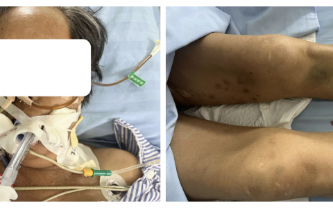 皮肤越来越黑了