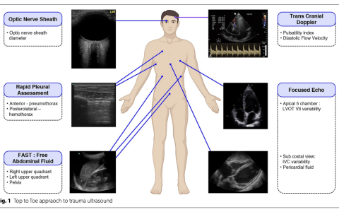 快速从头到脚的床边超声（POCUS）