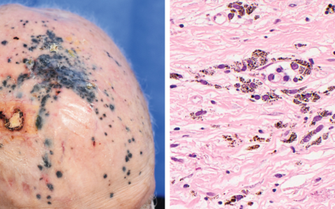 每日一题_2025.02.06