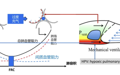 机械通气如何影响右心后负荷？