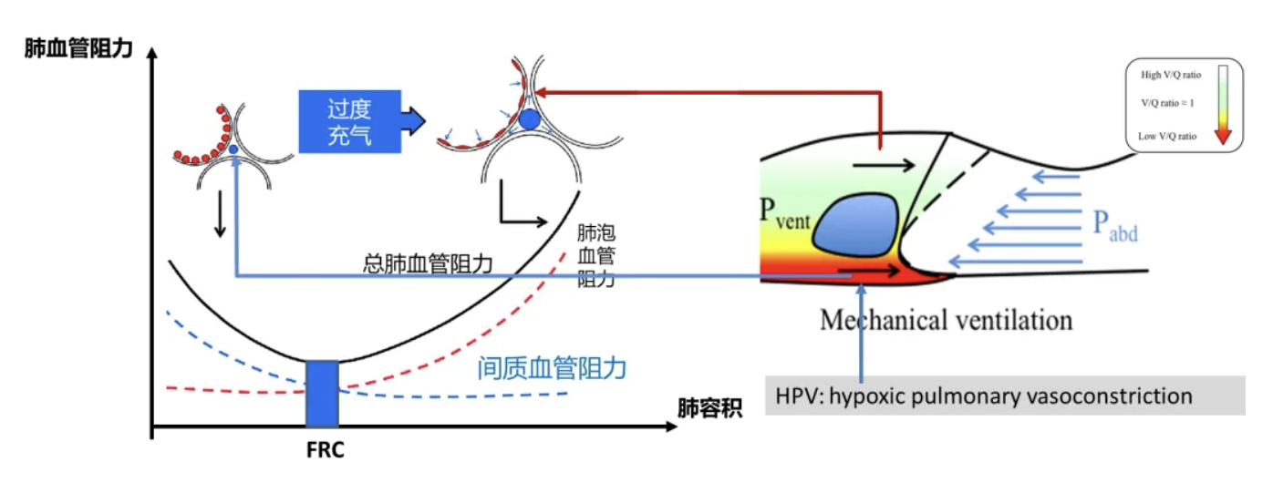 机械通气如何影响右心后负荷？