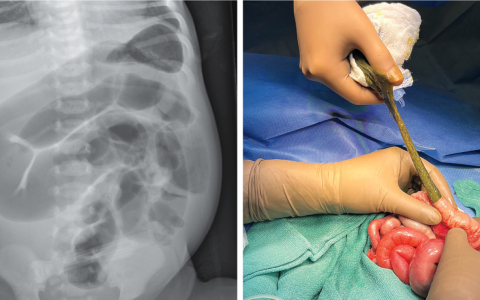 每日一题_2025.03.22