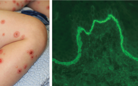 每日一题_2025.03.06