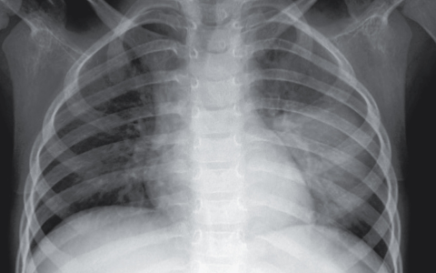 每日一题_2025.04.11