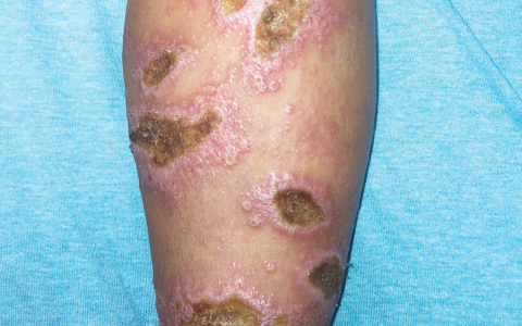 每日一题_2025.04.17