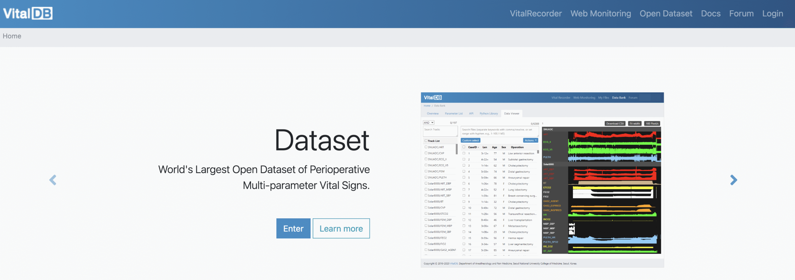 麻醉数据库：vitaldb