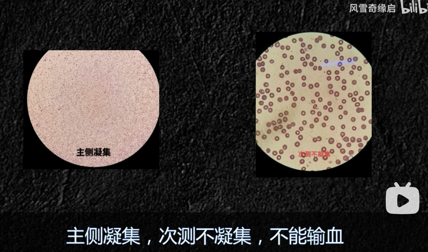 交叉配血