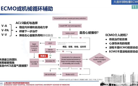 打麻将肺栓塞ECMO治疗：模式和时机 郭震