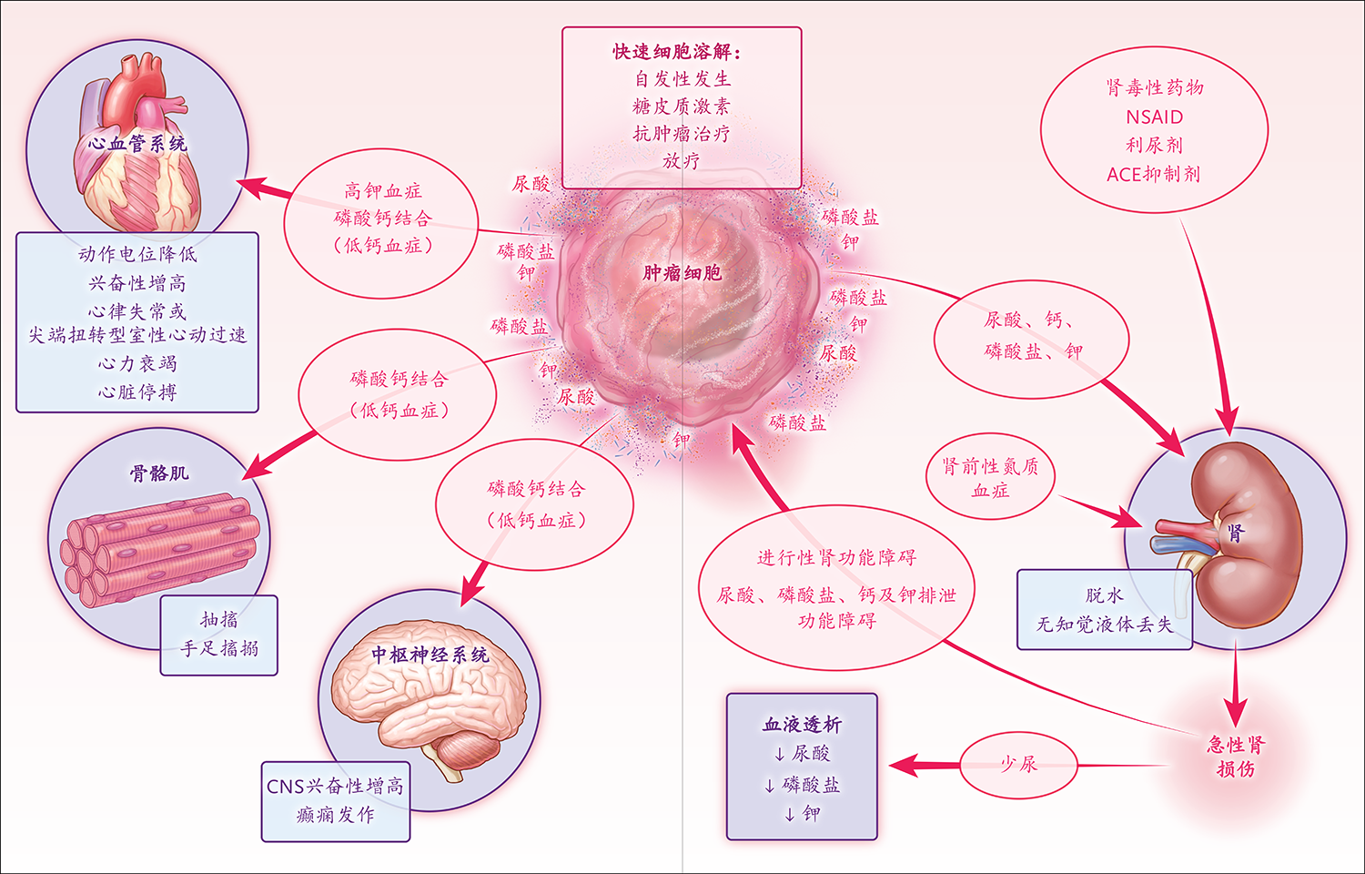 NEJM:肿瘤溶解综合征