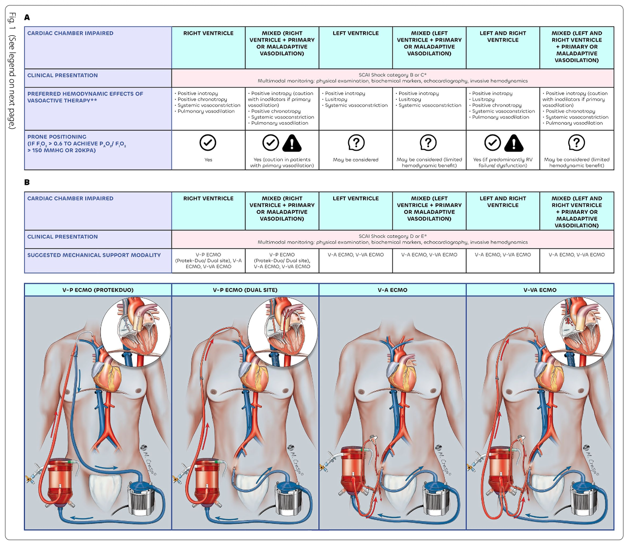 ICM:严重急性呼吸窘迫综合征中的心源性休克：心肺体外生命支持的作用