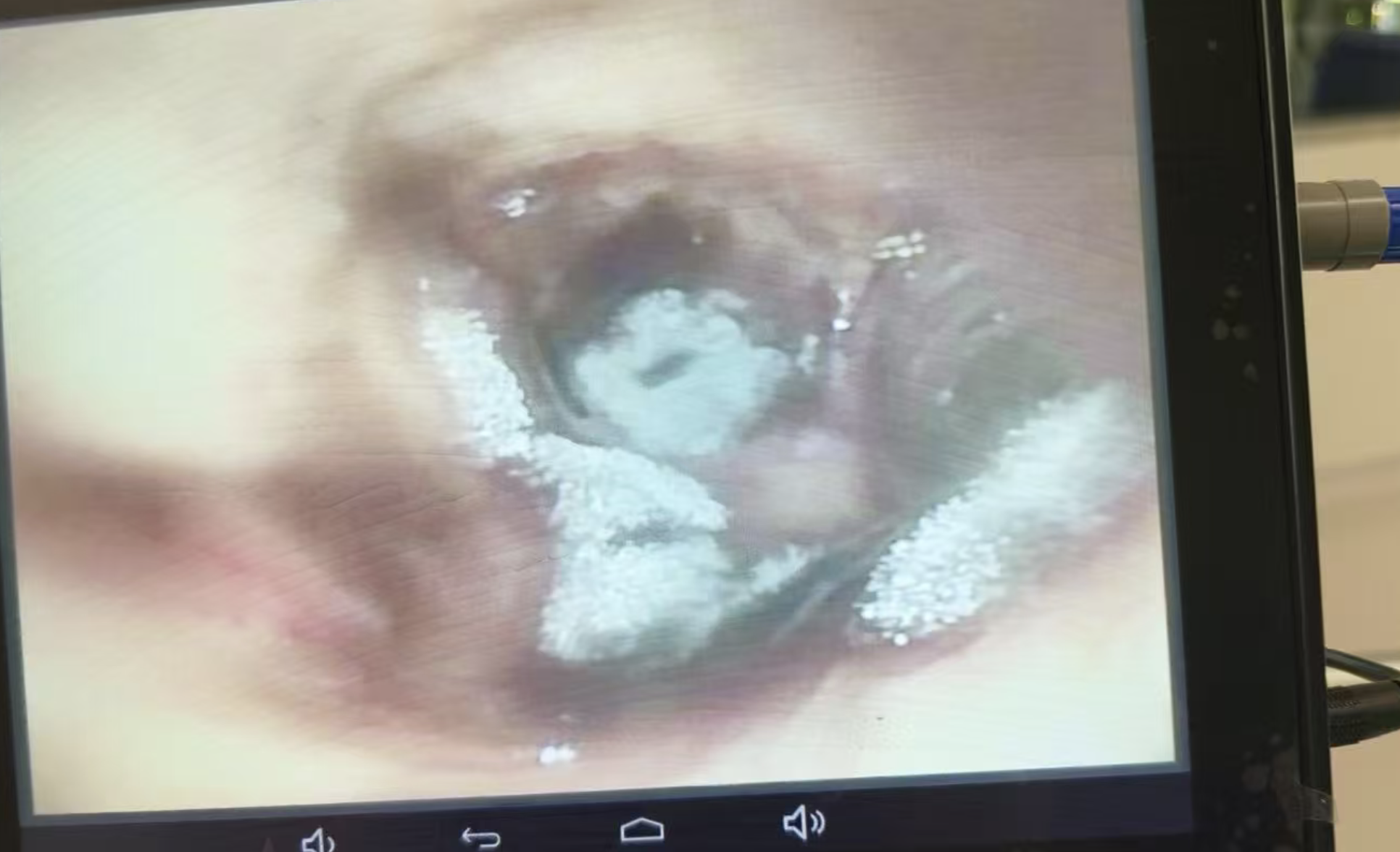 猜猜有几种真菌？