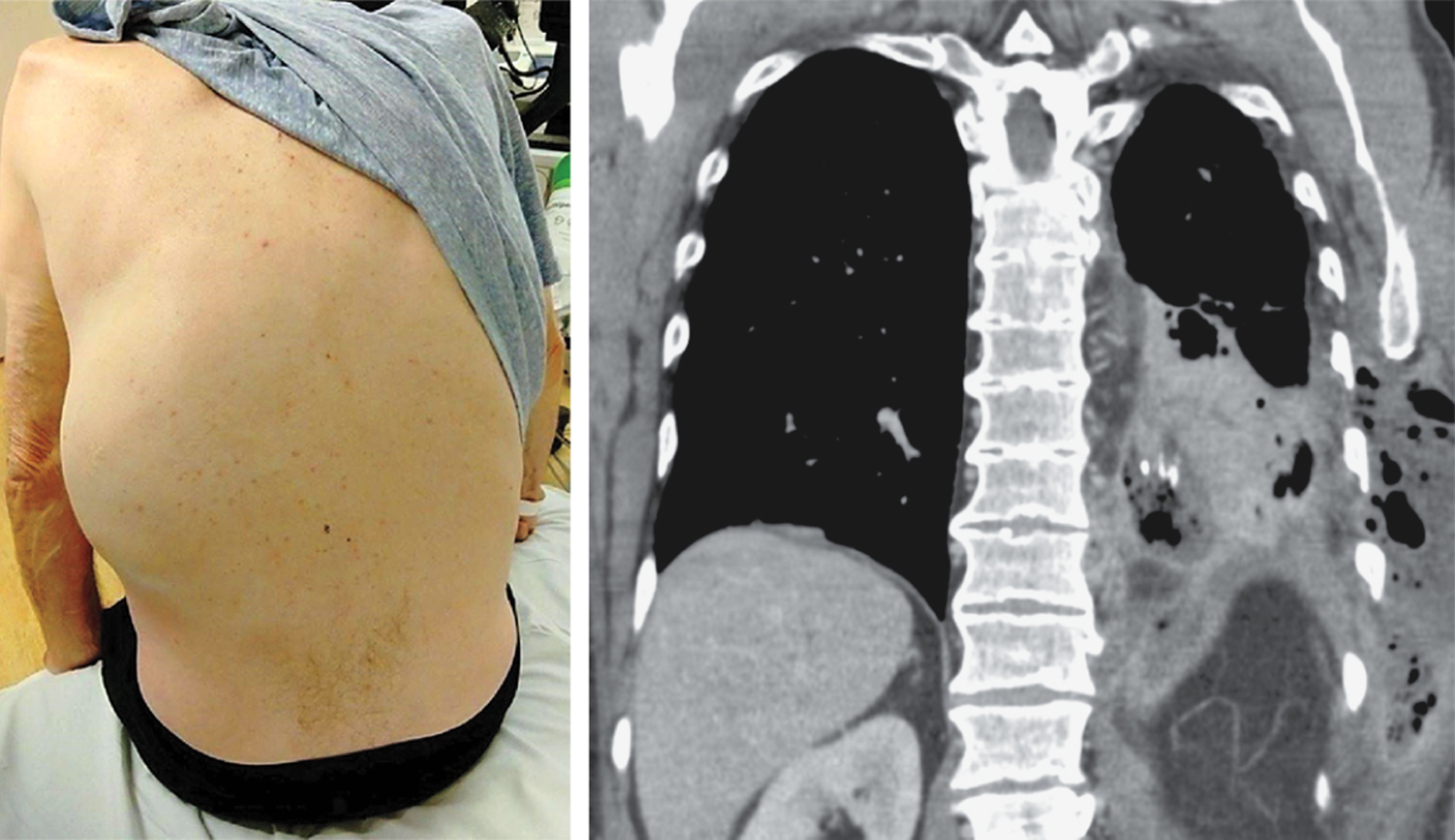 每日一题_2025.11.30