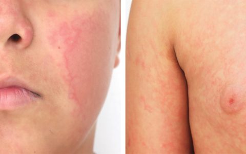 每日一题_2025.11.06