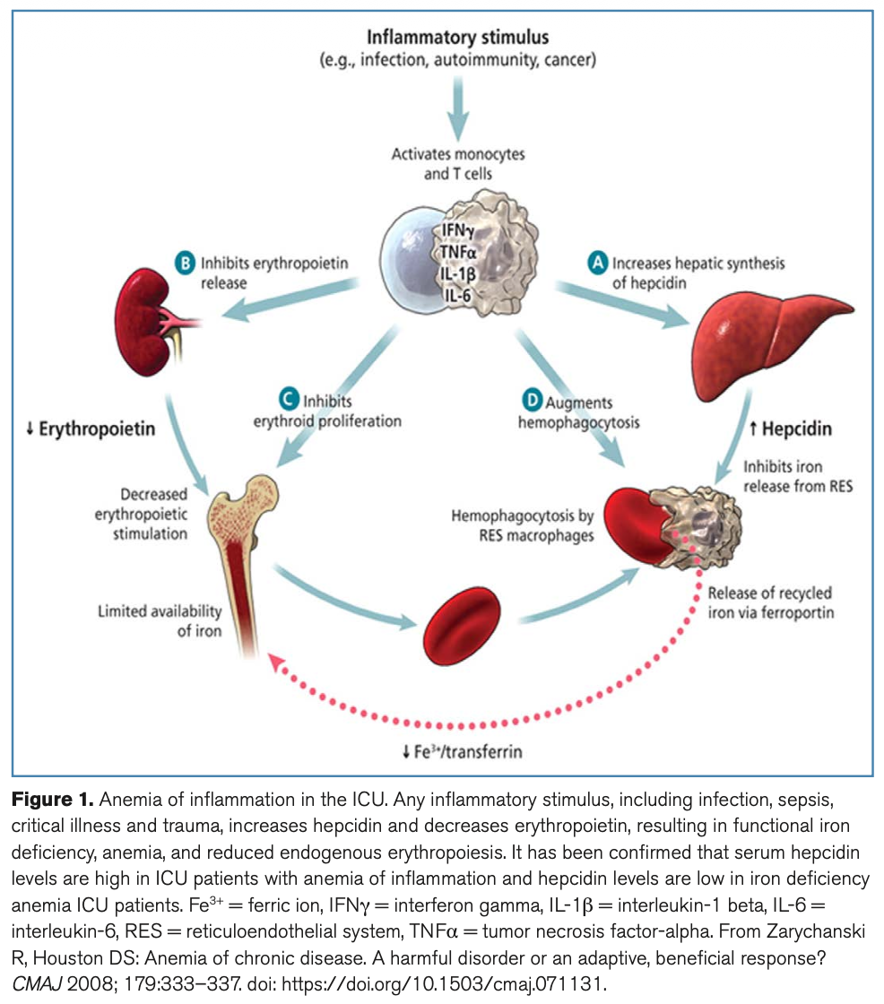 CCM:危重病性贫血：重症监护中的简明权威综述