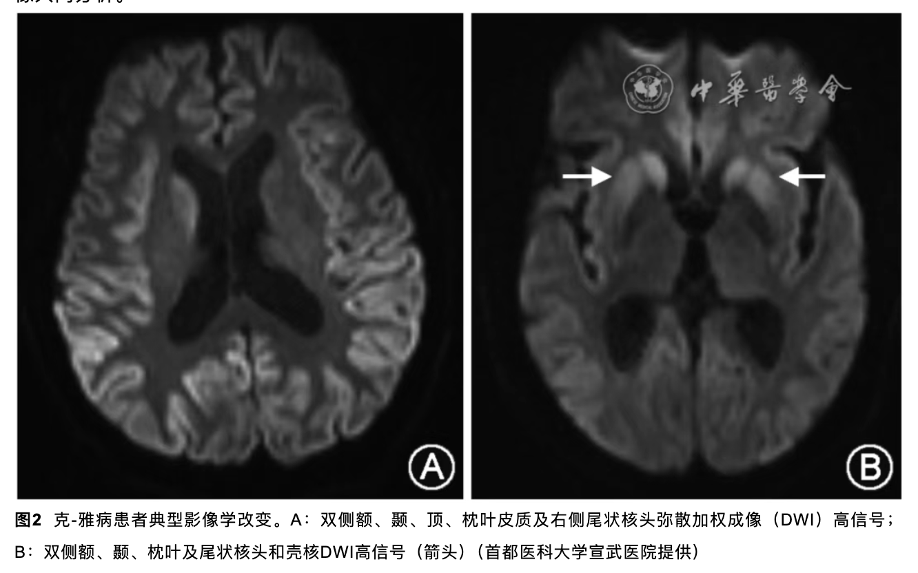 男性，59岁，意识障碍待查