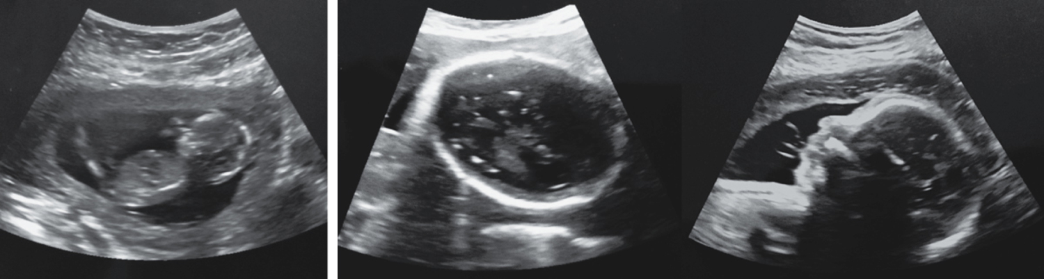 每日一题_2025.12.19