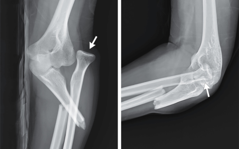 每日一题_2025.12.04