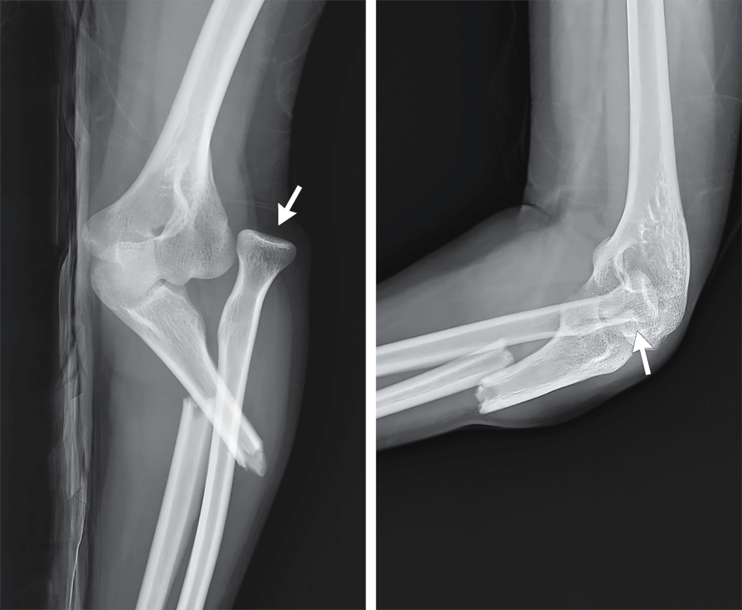 每日一题_2025.12.04