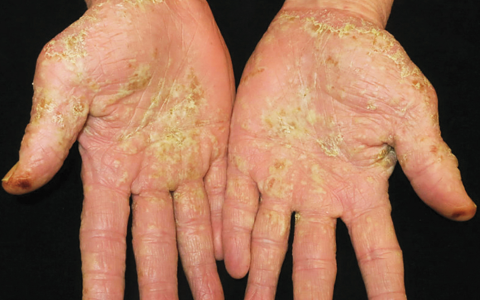 每日一题_2026.01.09