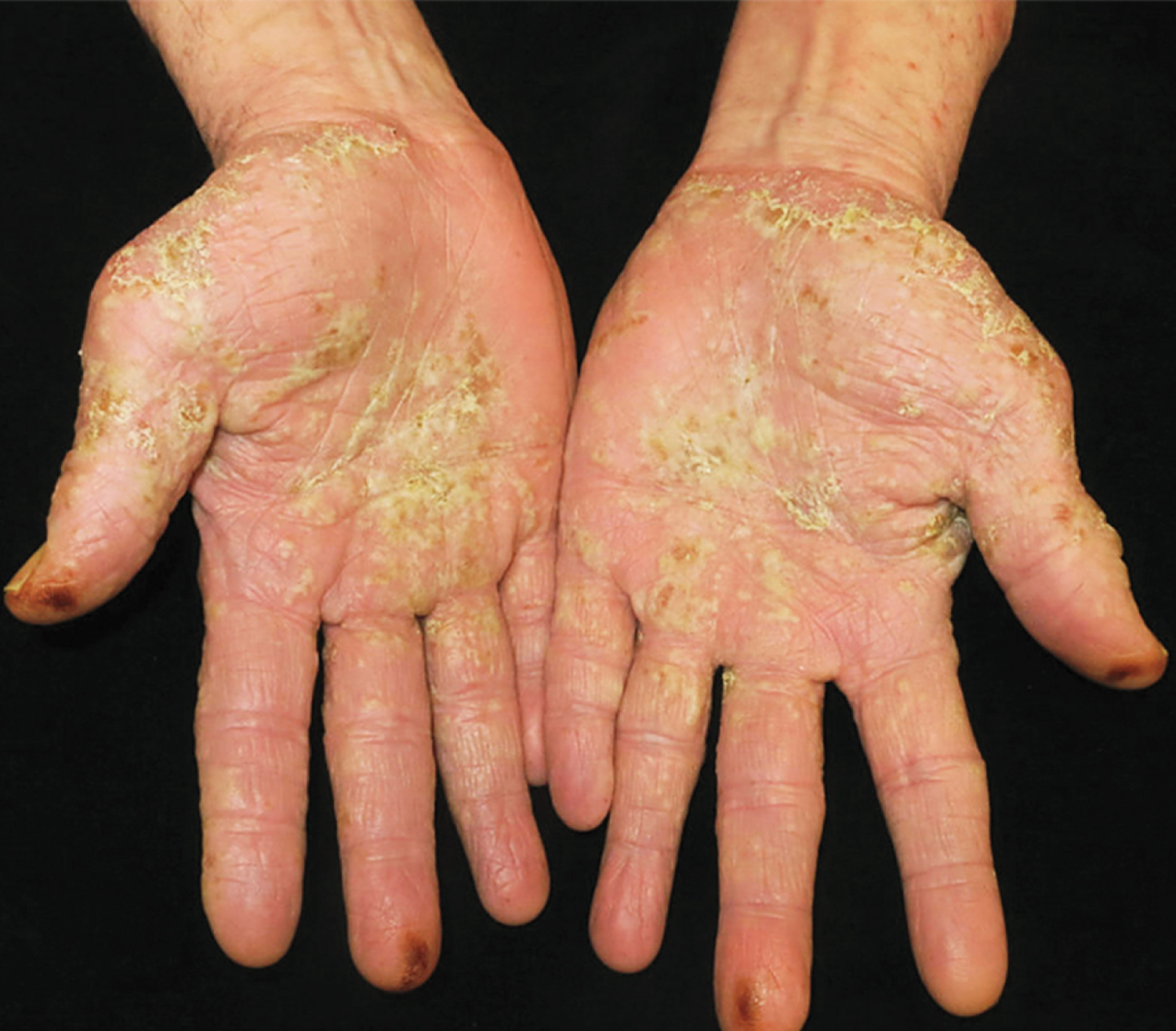 每日一题_2026.01.09