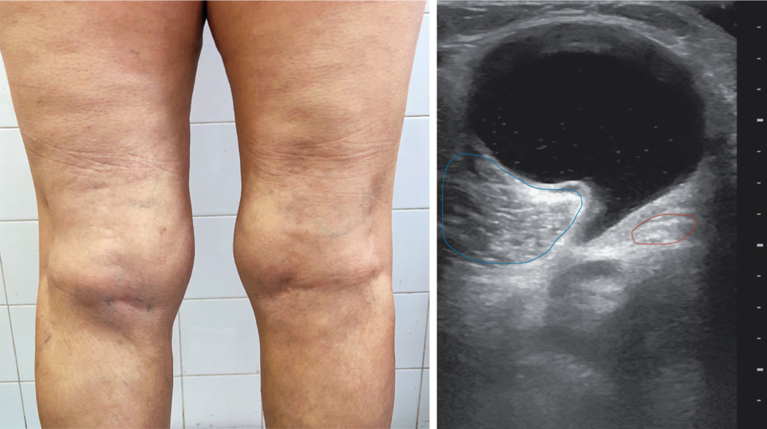 每日一题_2026.01.22