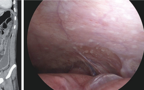 每日一题_2026.02.12