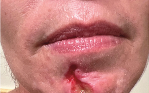 每日一题_2026.02.27