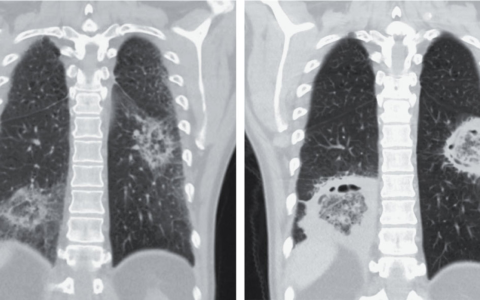 每日一题_2026.02.05