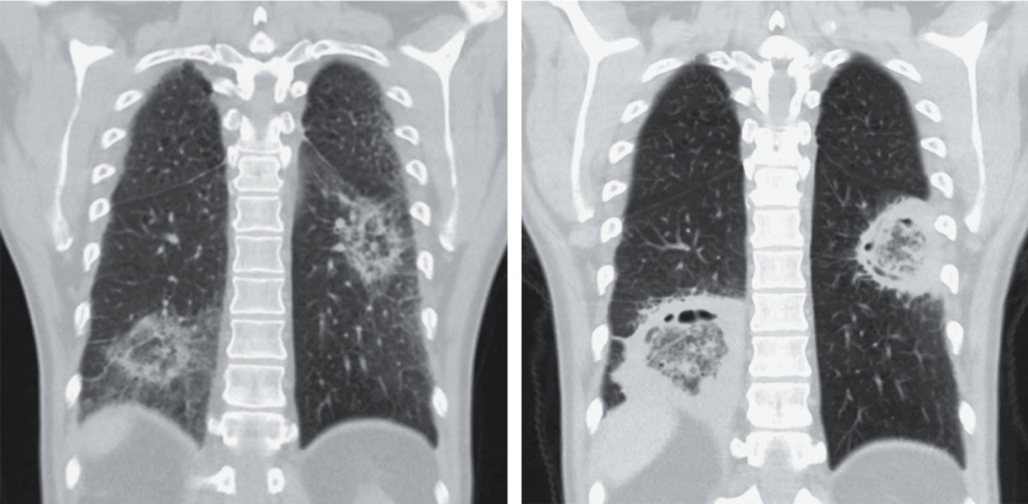 每日一题_2026.02.05