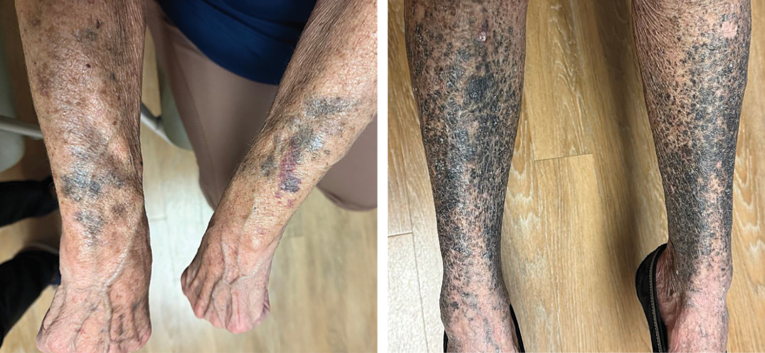 每日一题_2026.03.26