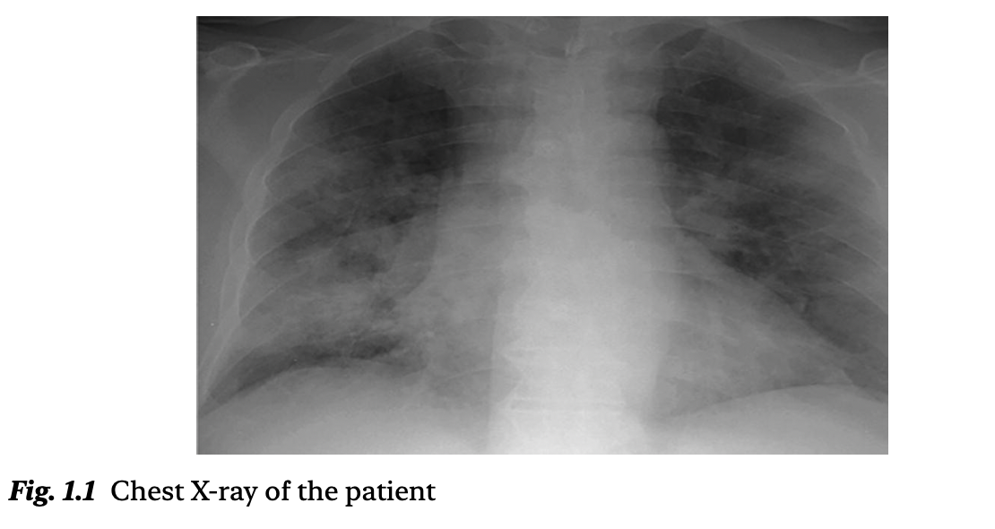 夜猫子读书日记：第一章：气道管理