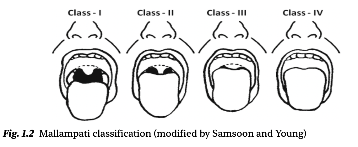 夜猫子读书日记：第一章：气道管理