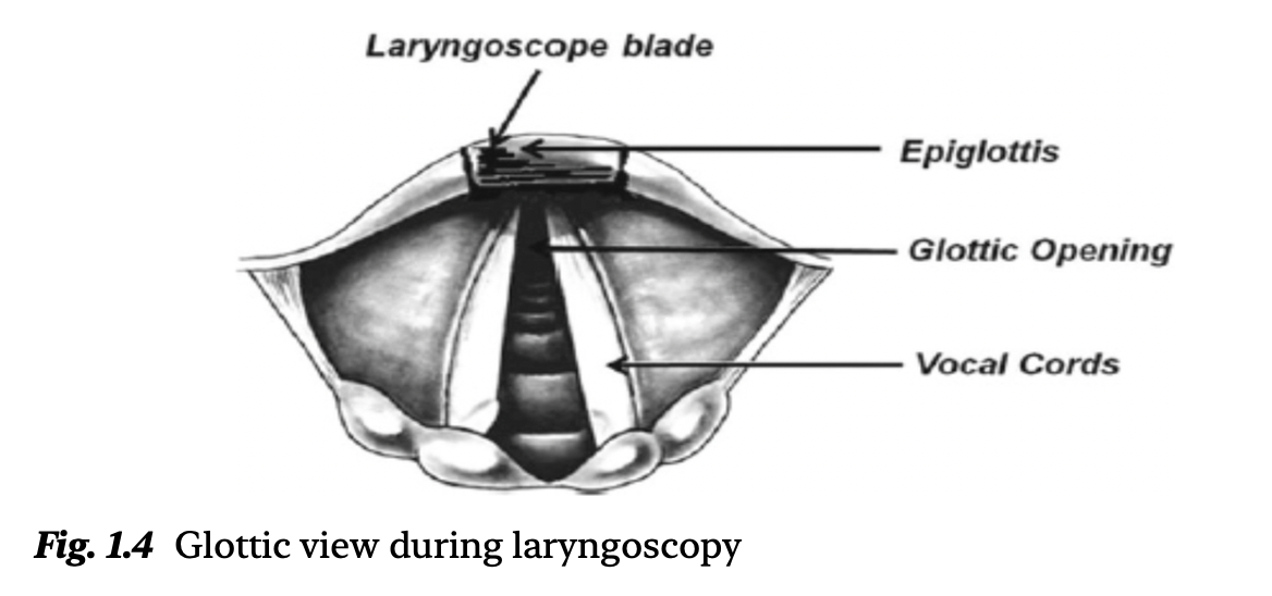 夜猫子读书日记：第一章：气道管理