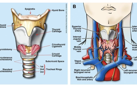 气管切开解剖图