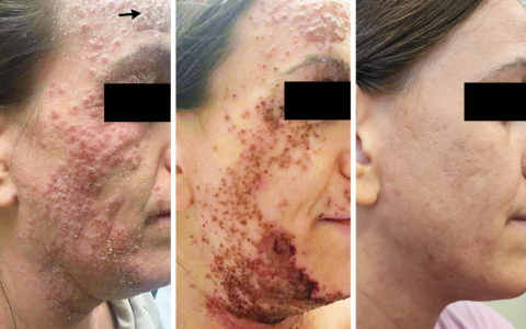 每日一题_2026.03.12