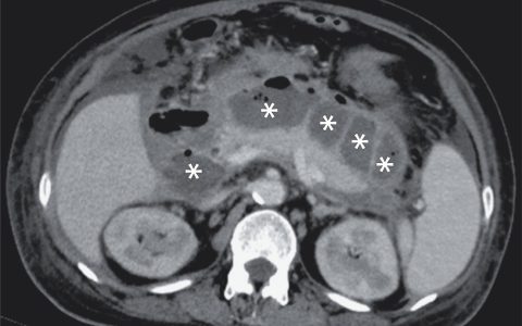 每日一题-2026.03.20