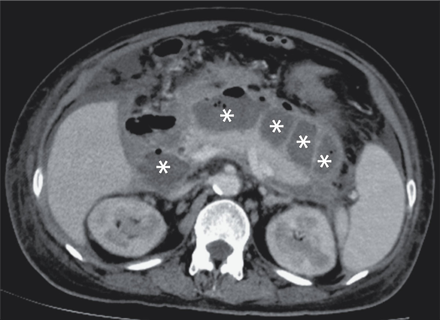 每日一题-2026.03.20