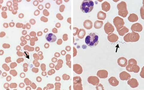 每日一题_2026.03.05