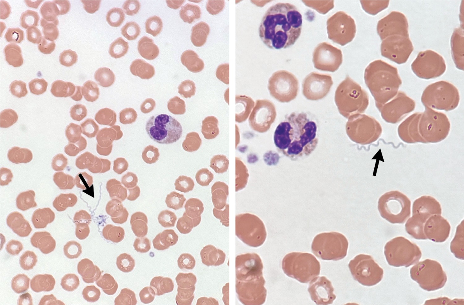 每日一题_2026.03.05