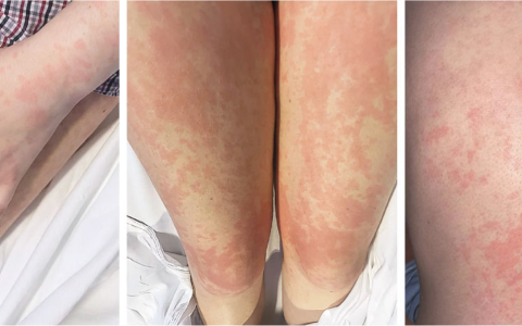 每日一题_2026.04.10