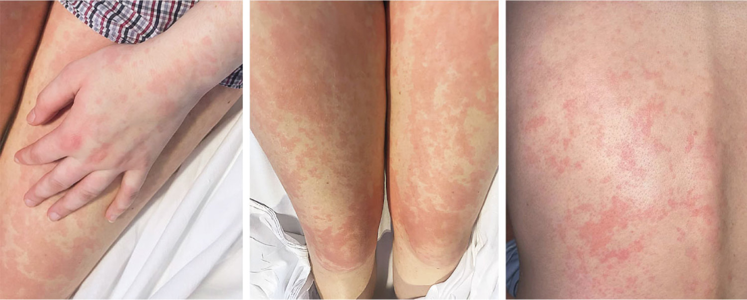 每日一题_2026.04.10