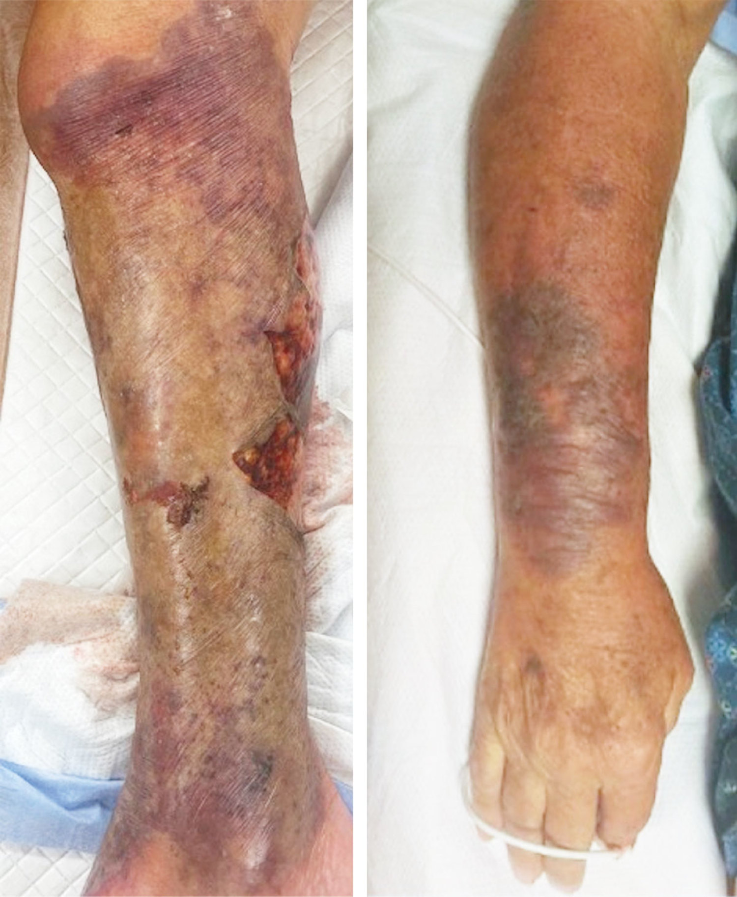 每日一题_2026.04.17