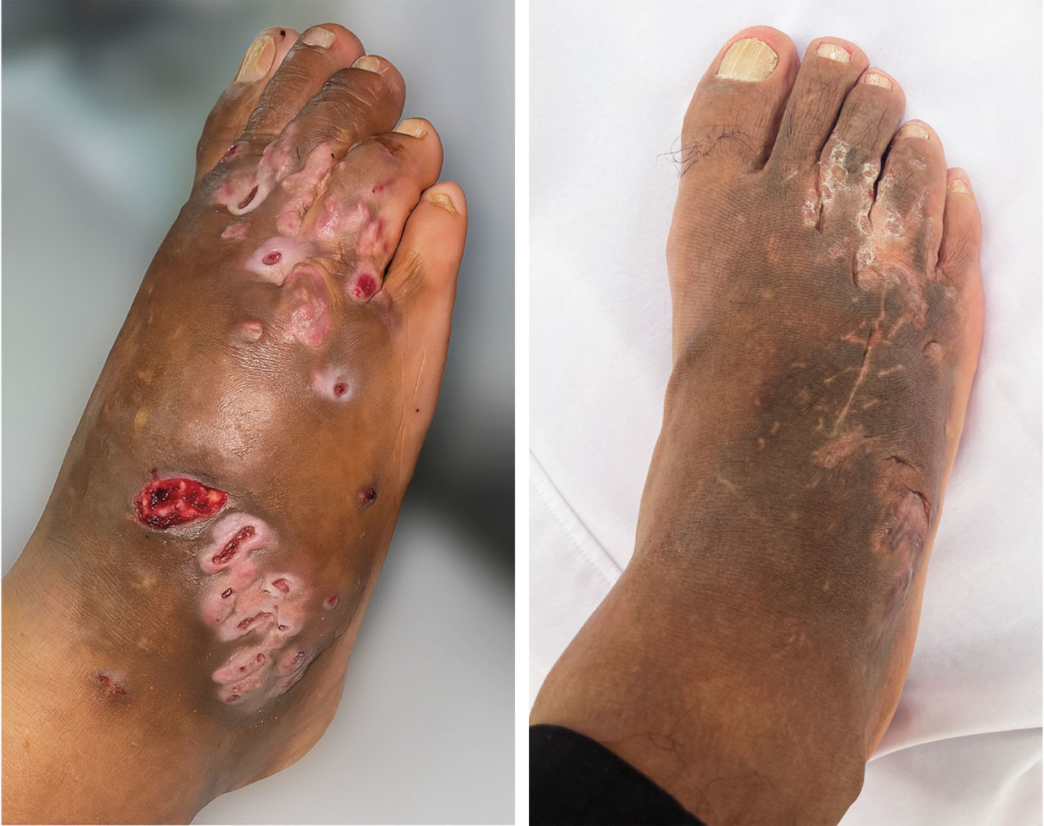 每日一题_2026.04.23