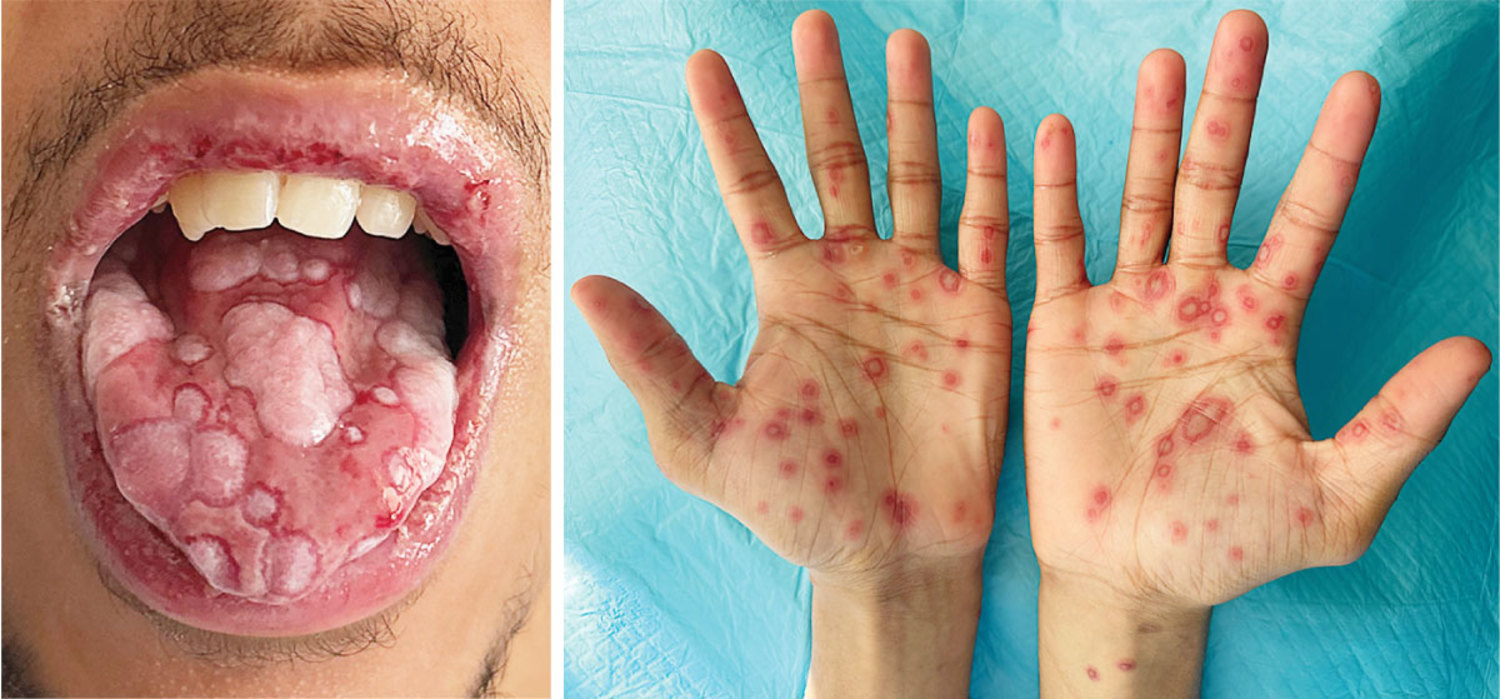 每日一题_2026.04.30