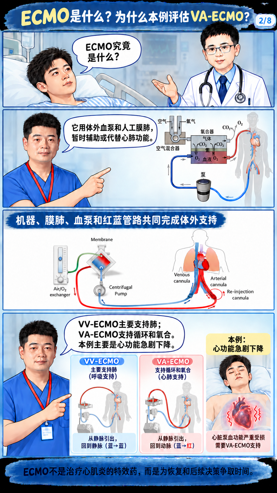 什么患者合适上ECMO?什么患者不合适?